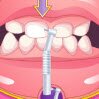Bad Teeth Makeover Games : Today we are going to introduce you an extremely beautiful g ...